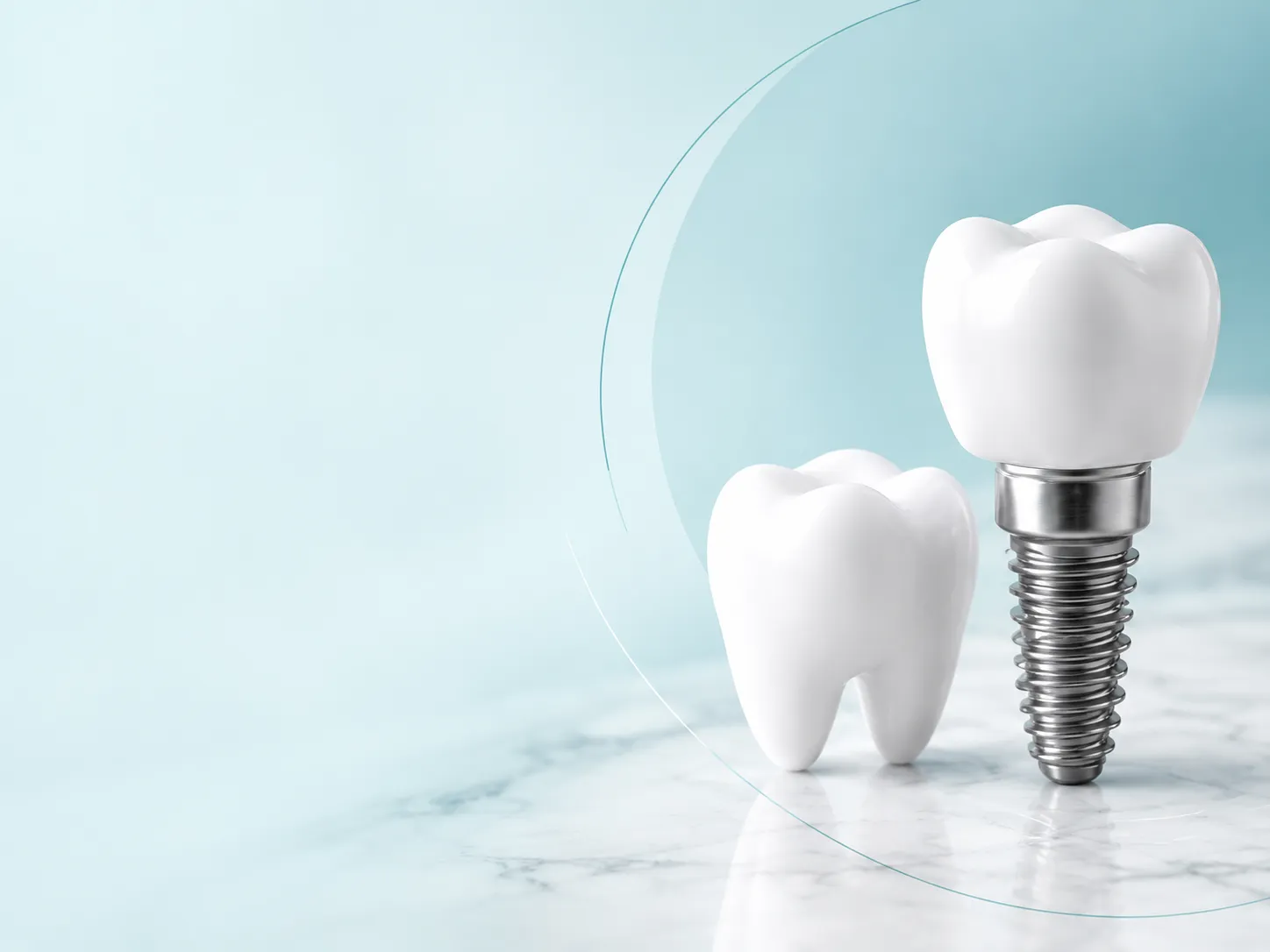 Dental implant and natural tooth on marble